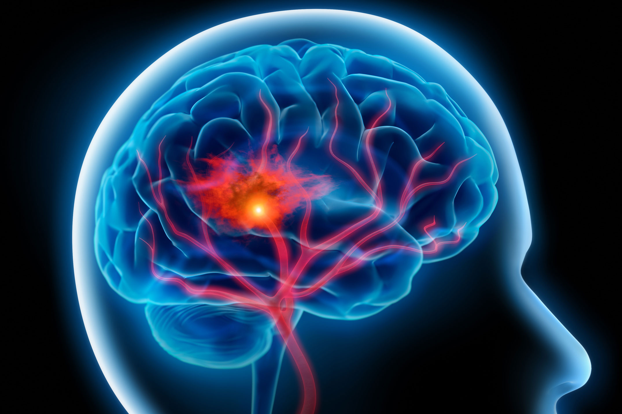 Lunch & Learn<br>Free virtual series<br>June 15 | All ages<br>Discover ways to protect your brain health.